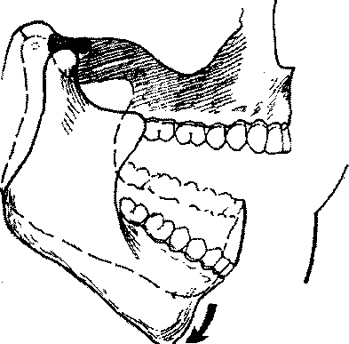 Мыщелок челюсти. Биомеханика нижней челюсти ортопедия. ВНЧС биомеханика нижней челюсти. Клиническая биомеханика нижней челюсти.