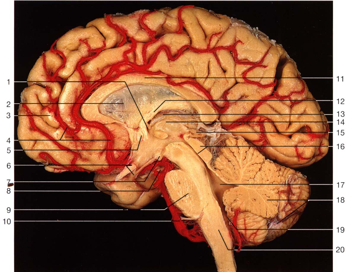 Мозговые артерии. Артерии головного мозга. Средняя мозговая артерия.