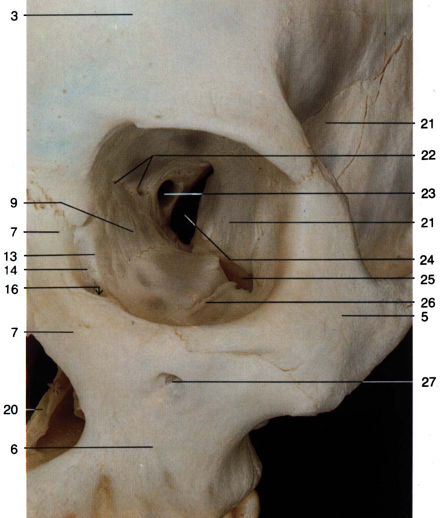Части глазницы. Глазничная кость анатомия. Топография черепа глазница. Глазница анатомия Синельников. Полость глазницы анатомия.
