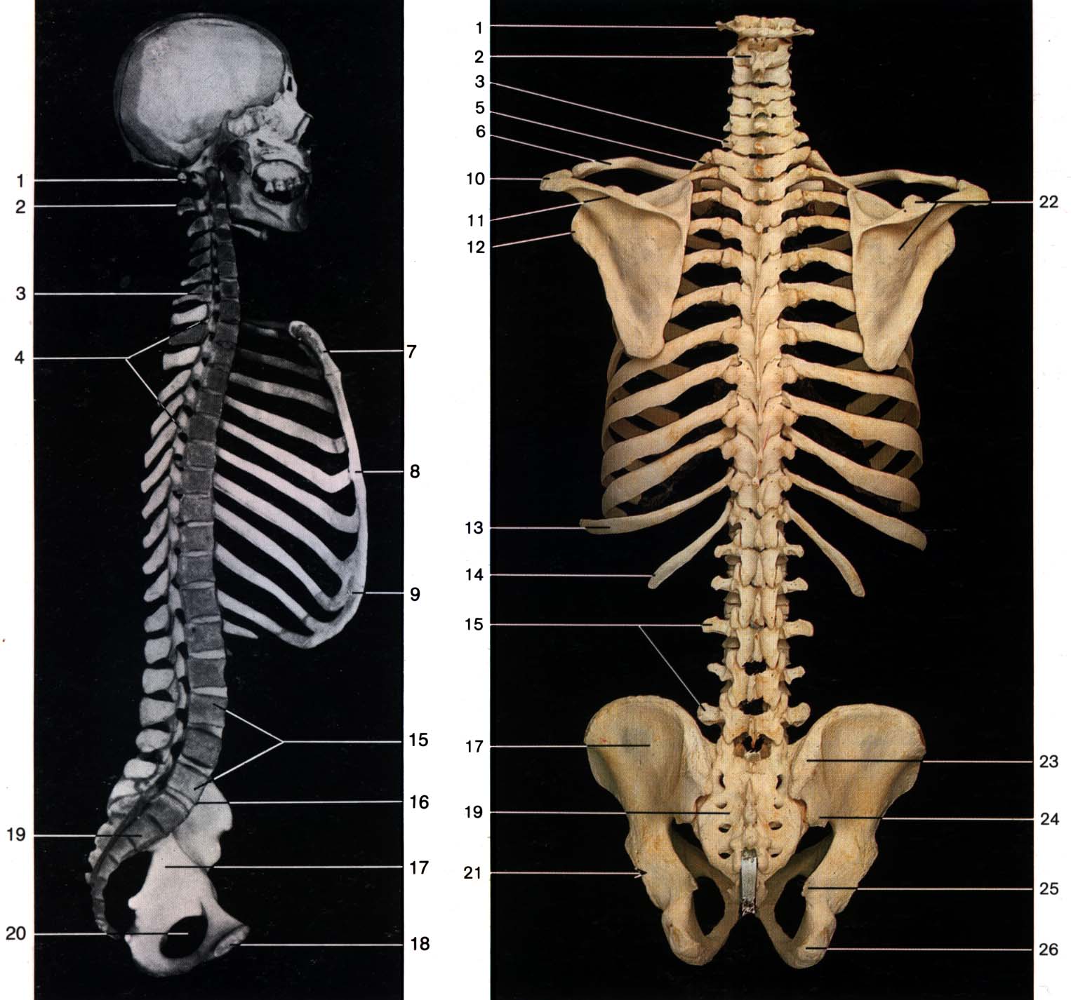 Скелет человека позвоночник с надписями фото